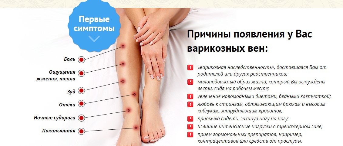 симптомы варикоза на ногах visionural.com